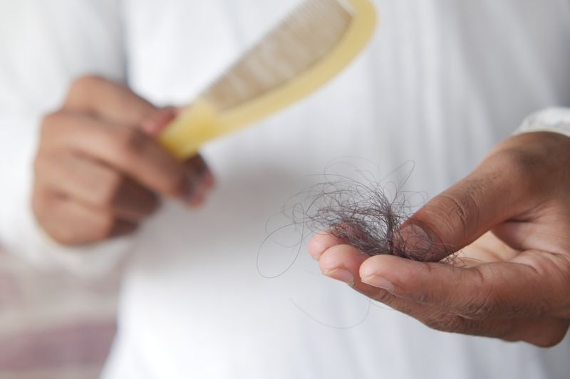 Why women lose hair differently androgenic alopecia explained