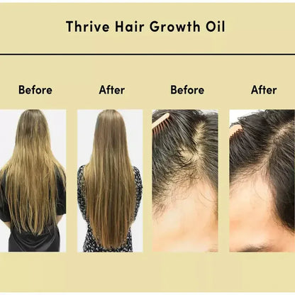 Natural Hair Growth Serum - Thrive Hair Oil - NOORWA