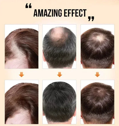 Anti-Drop Nourishing & Repairing Hair Serum - www.noorwa.com