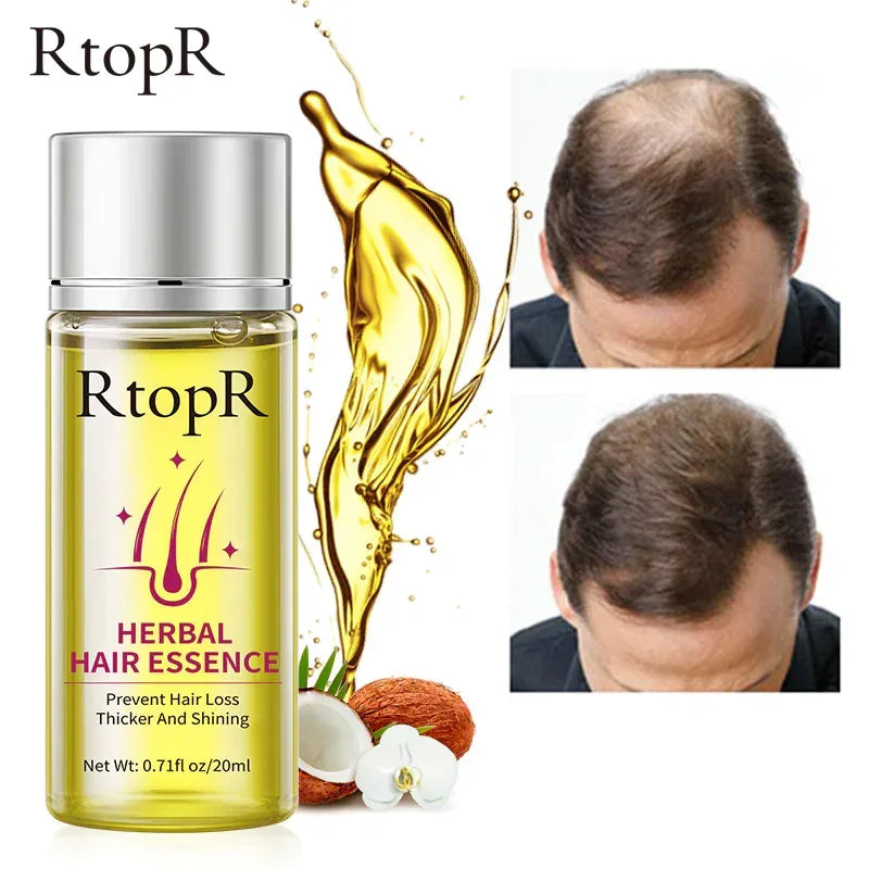 RtopR Herbal Hair Oil for Hair Growth and Nourishment - NOORWA