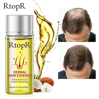 RtopR Herbal Hair Oil for Hair Growth and Nourishment - NOORWA